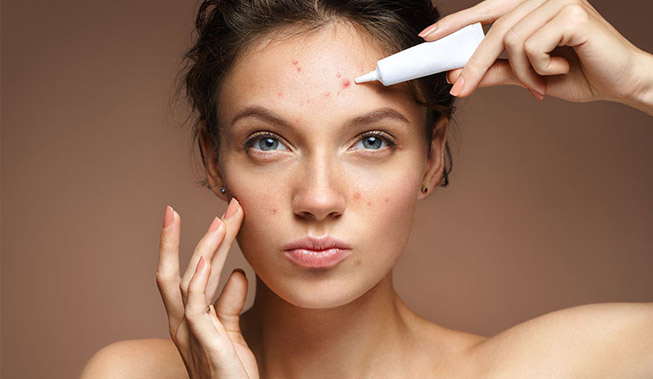 remove acne cosmetology
