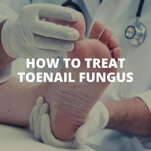 How to treat toenail fungus - SIXMD - Vietnamese Online Shop
