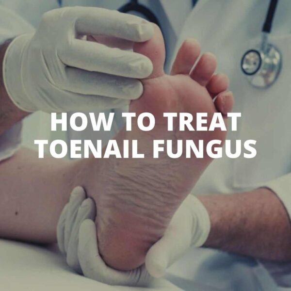 How to treat toenail fungus SIXMD Vietnamese Online Shop