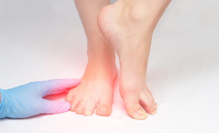 Causes of toenail fungus
