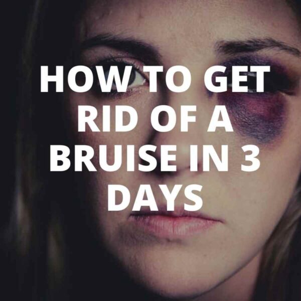 How to get rid of a bruise in 3 days Vietnamese online shop