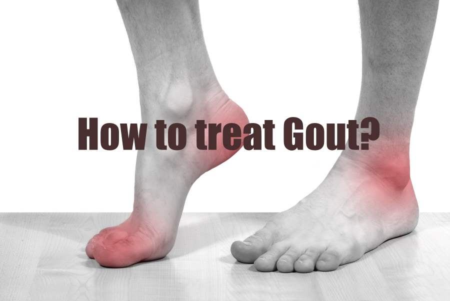 How to treat Gout