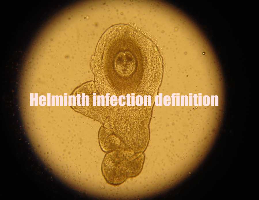 How to definition helminth infection